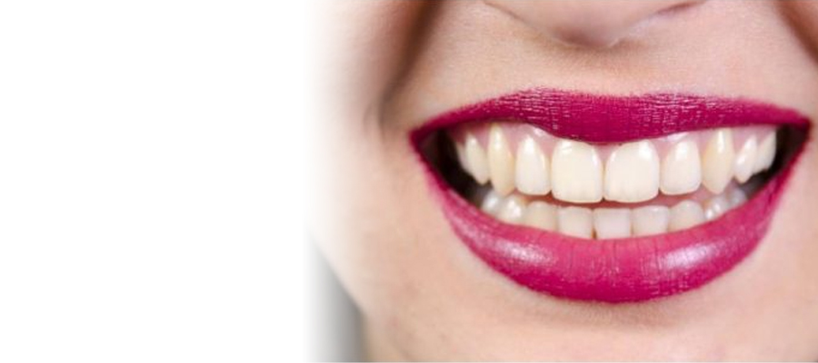 Fără tratament ortodontic