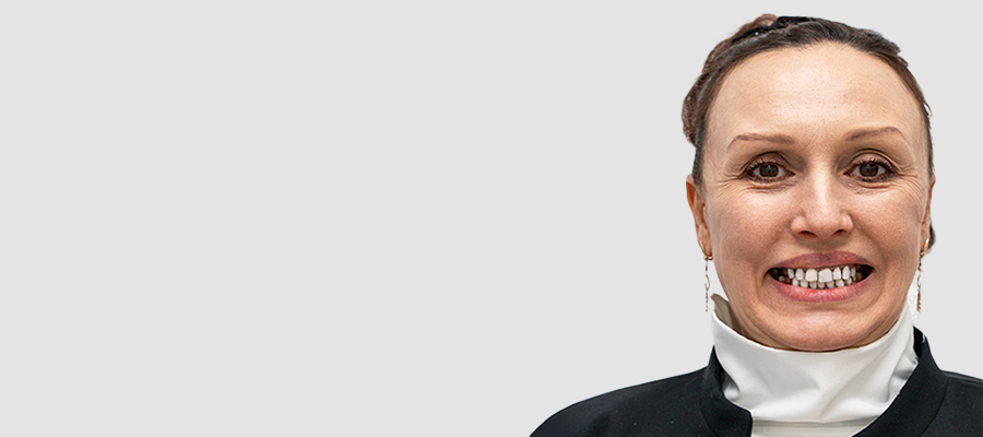 Fără fațete dentare