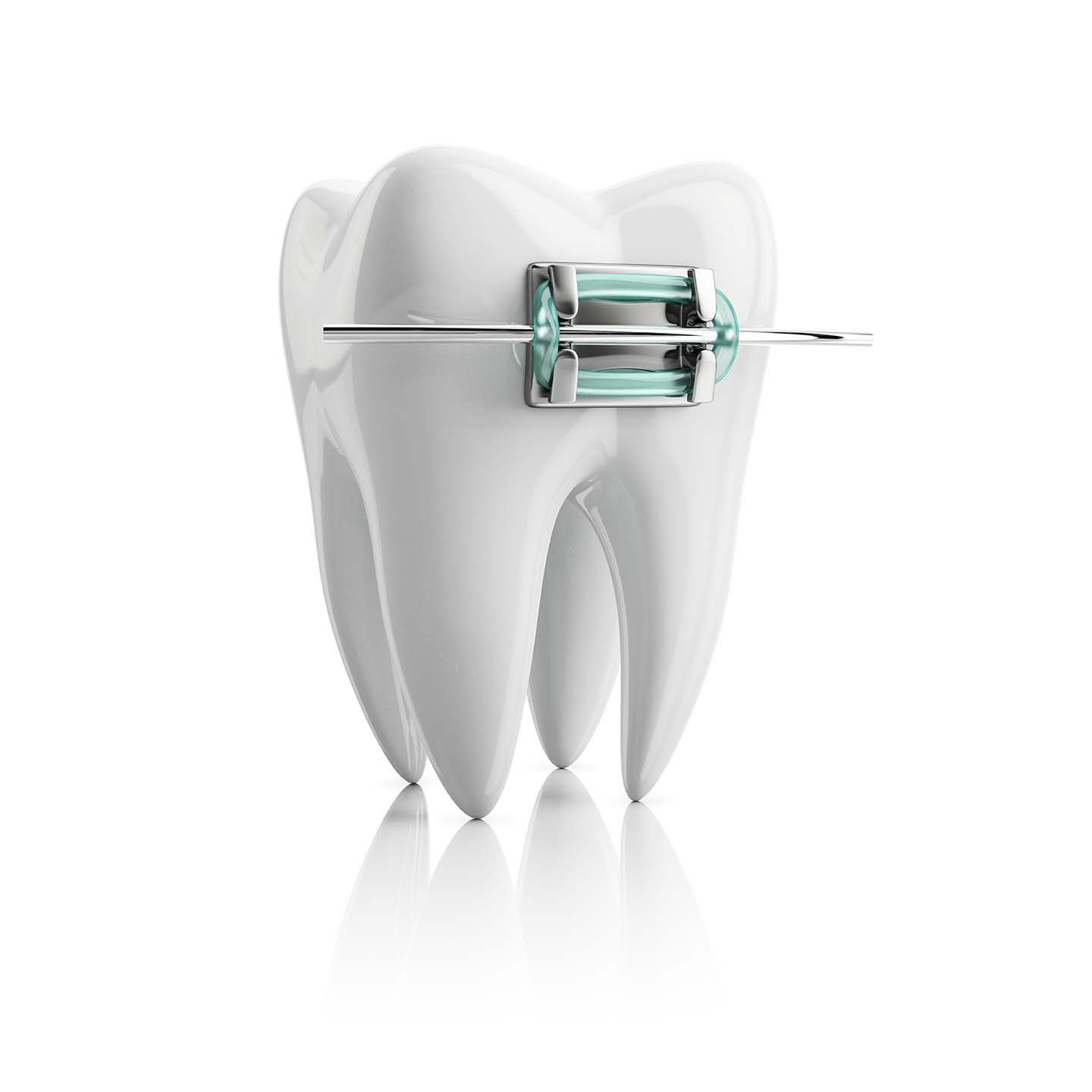 Dacă te regăsești în aceste situații, aparatul dentar este soluția pentru tine