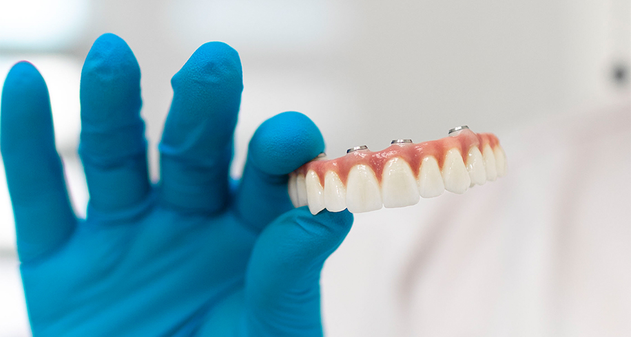 DINȚI FICȘI ÎN 72 ORE