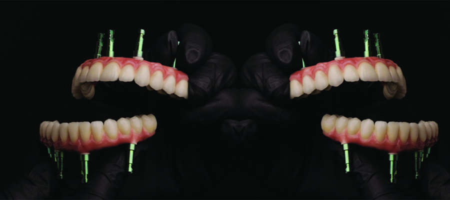 Dantură fixă pe implanturi